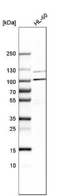 Western Blot: AP5Z1 Antibody [NBP1-92049]