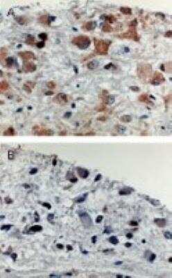 Immunohistochemistry: APAF-1 Antibody [NB100-56074]