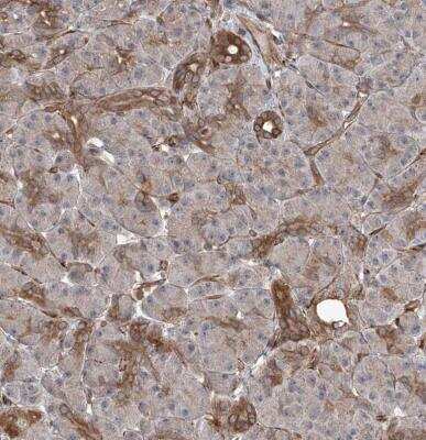 Immunohistochemistry-Paraffin: APAF-1 Antibody [NBP1-89050]