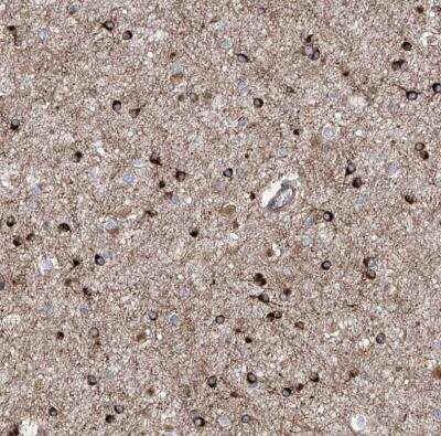 Immunohistochemistry-Paraffin: APAF-1 Antibody [NBP1-89050]