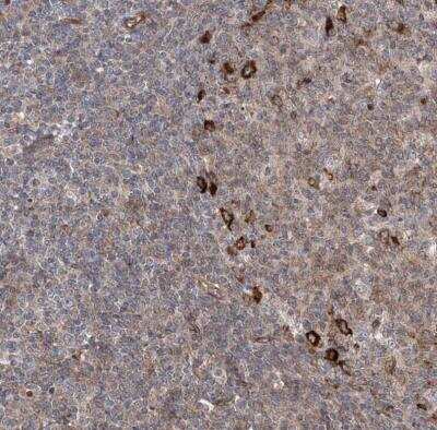 Immunohistochemistry-Paraffin: APAF-1 Antibody [NBP1-89050]