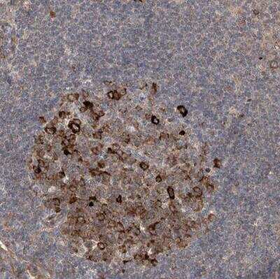 Immunohistochemistry-Paraffin: APAF-1 Antibody [NBP1-89050]
