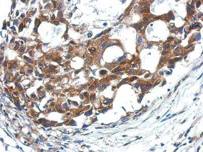 Immunohistochemistry-Paraffin: APAF-1 Antibody [NBP2-15420]