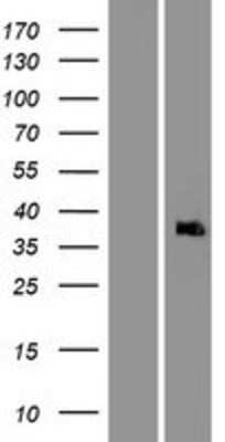 Western Blot: APAF-1 Overexpression Lysate [NBP2-04870]