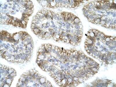 Immunohistochemistry: APBA1 Antibody [NBP3-10874]