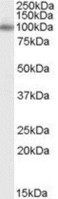 Western Blot: APBA1 Antibody [NBP1-06015]