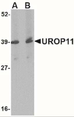 Western Blot: APBA1 AntibodyBSA Free [NBP2-41085]