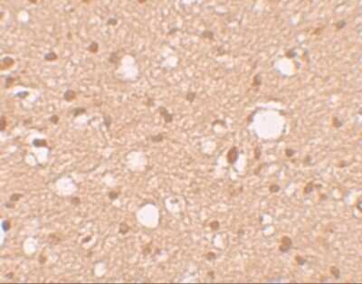 Immunohistochemistry: APBA2 Antibody - BSA Free [NBP2-41127]