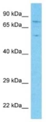 Western Blot: APBA2 Antibody [NBP3-10789]