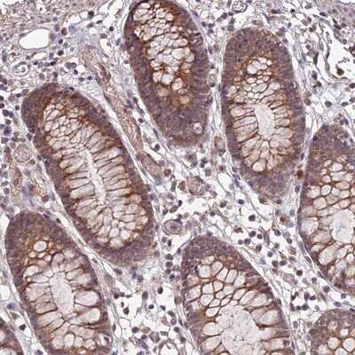 Immunohistochemistry-Paraffin: APBA3/Mint-3 Antibody [NBP1-92117]