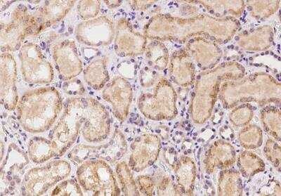 Immunohistochemistry-Paraffin: APBA3/Mint-3 Antibody [NBP3-06040]