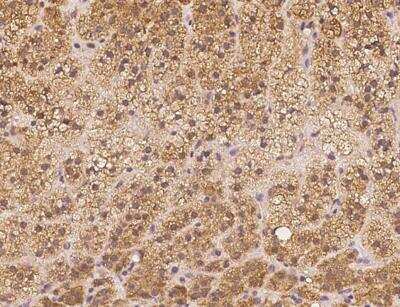Immunohistochemistry-Paraffin: APBA3/Mint-3 Antibody [NBP3-06040]