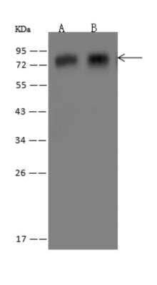 Western Blot: APBA3/Mint-3 Antibody [NBP3-06040]