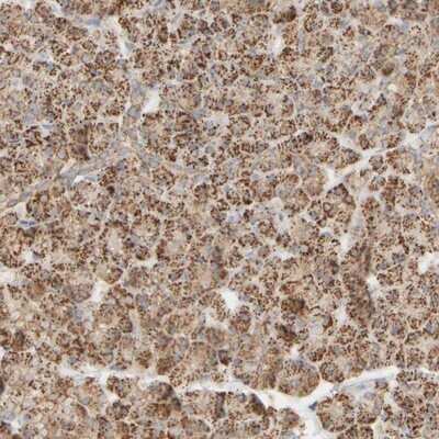 Immunohistochemistry-Paraffin: APBB2 Antibody [NBP1-84700]