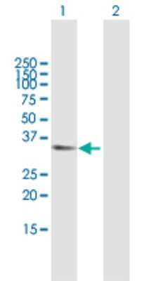 Western Blot: APBB2 Antibody [H00000323-B01P]