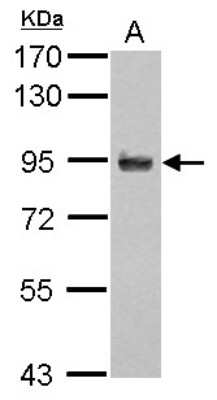 Western Blot: APBB2 Antibody [NBP2-15421]