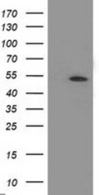 Western Blot: APBB3 Antibody (OTI5G3) [NBP2-01367]