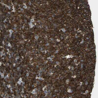 Immunohistochemistry-Paraffin: APBB3 Antibody [NBP1-84699]