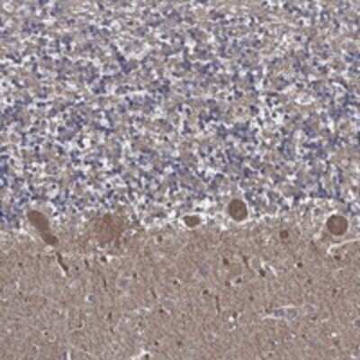 Immunohistochemistry-Paraffin: APBB3 Antibody [NBP3-17683]