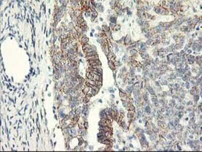 Immunohistochemistry: APBB3 Antibody (OTI5G3) - Azide and BSA Free [NBP2-71585]