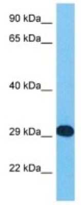 Western Blot: APBB3 Antibody [NBP3-10783]