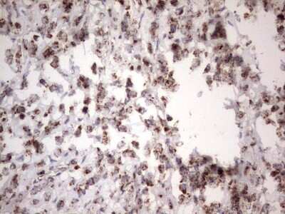 Immunohistochemistry: APC Antibody (OTI2B8) [NBP2-46529]