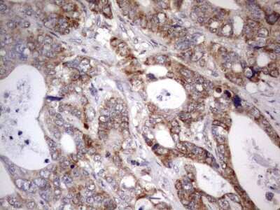 Immunohistochemistry: APC Antibody (OTI2B8) [NBP2-46529]