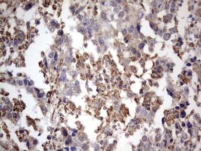 Immunohistochemistry: APC Antibody (OTI2B8) [NBP2-46529]