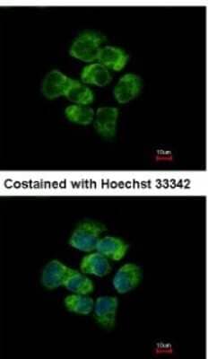 Immunocytochemistry/ Immunofluorescence: APC Antibody [NBP2-15422]