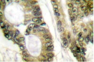 Immunohistochemistry-Paraffin: APC Antibody - BSA Free [NB100-91662]