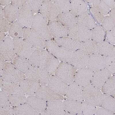 Immunohistochemistry-Paraffin: APC Antibody [NBP1-84994]