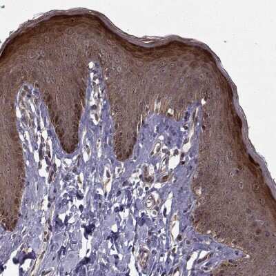 Immunohistochemistry-Paraffin: APC Antibody [NBP1-84994]