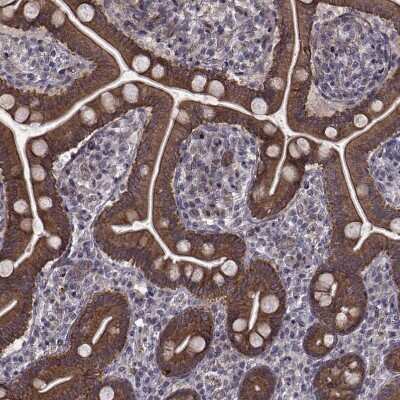 Immunohistochemistry-Paraffin: APC Antibody [NBP1-84994]