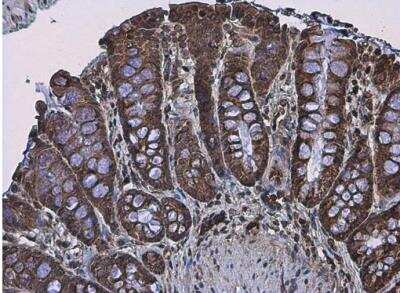 Immunohistochemistry-Paraffin: APC Antibody [NBP2-15422]