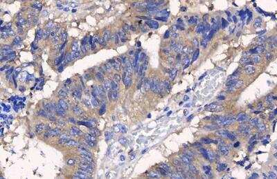Immunohistochemistry-Paraffin: APC Antibody [NBP2-15422]