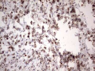 Immunohistochemistry: APC Antibody (OTI2B8) - Azide and BSA Free [NBP2-70183]