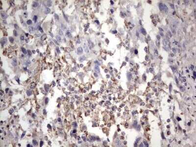 Immunohistochemistry: APC Antibody (OTI2B8) - Azide and BSA Free [NBP2-70183]