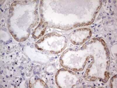 Immunohistochemistry: APC Antibody (OTI2B8) - Azide and BSA Free [NBP2-70183]