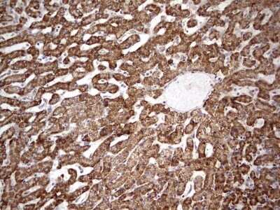 Immunohistochemistry: APC Antibody (OTI2B8) - Azide and BSA Free [NBP2-70183]