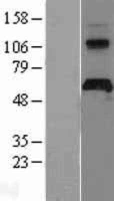 Western Blot: APCDD1 Overexpression Lysate [NBL1-07594]