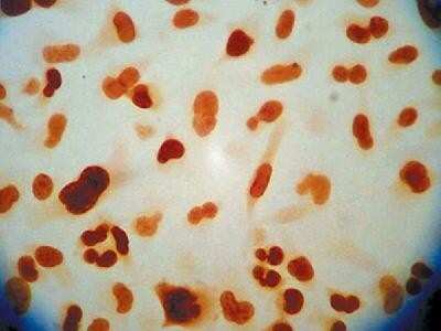 Immunocytochemistry/ Immunofluorescence: APE Antibody (13B8E5C2) - BSA Free [NB100-116]