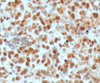 Immunohistochemistry-Paraffin: APE Antibody (13B8E5C2) - BSA Free [NB100-116]
