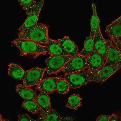 Immunocytochemistry/ Immunofluorescence: APE Antibody (CPTC-APEX1-2) [NBP3-07864]