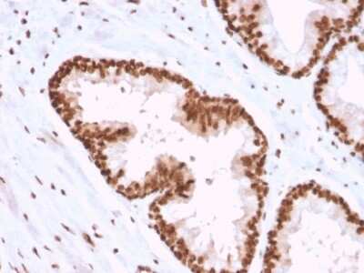 Immunohistochemistry-Paraffin: APE Antibody (CPTC-APEX1-2) - Azide and BSA Free [NBP3-08370]