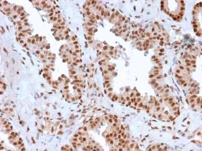 Immunohistochemistry-Paraffin: APE Antibody (CPTC-APEX1-2) - Azide and BSA Free [NBP3-08370]