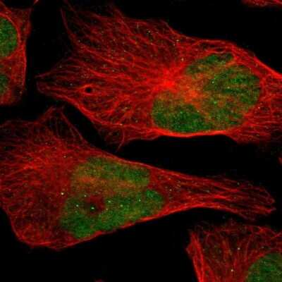 Immunocytochemistry/ Immunofluorescence: APE Antibody [NBP2-54653]