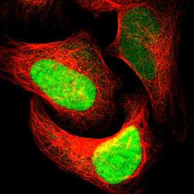 Immunocytochemistry/ Immunofluorescence: APE Antibody [NBP2-76495]