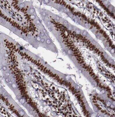 Immunohistochemistry-Paraffin: APE Antibody [NBP2-54653]