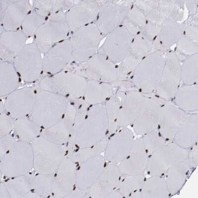 Immunohistochemistry-Paraffin: APE Antibody [NBP2-54653]