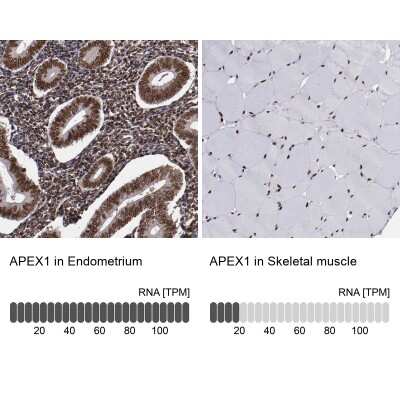 Immunohistochemistry-Paraffin: APE Antibody [NBP2-54653]
